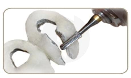 Metal & Crown cutting burs