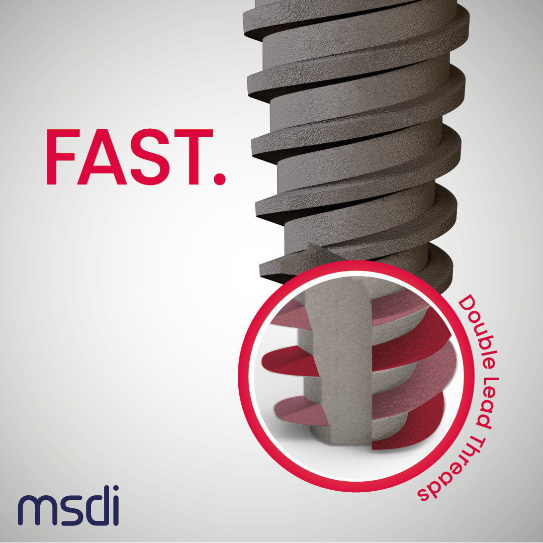 Alef dental implant